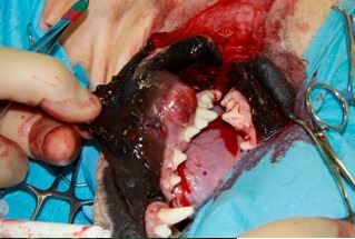 Oral Mass Prior to Surgery